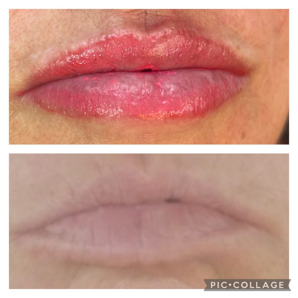 Lips